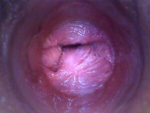 キラ - キンキーセルフィー(内視鏡プッシーカムビデオ)